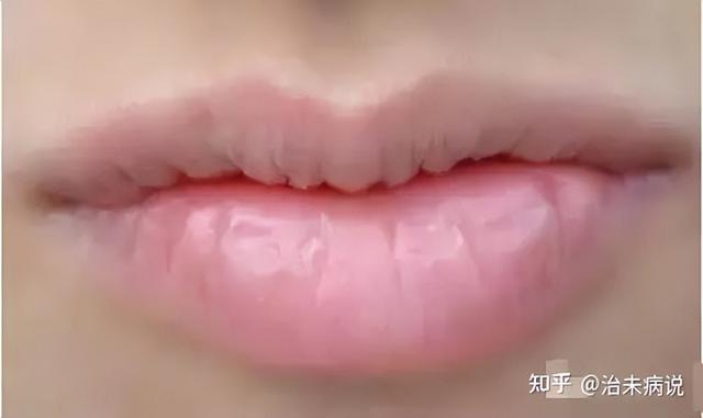 婴儿胃图片位置示意图,婴儿胃的位置图片