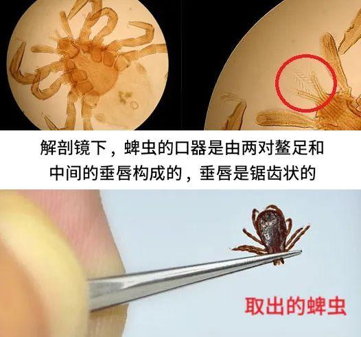 蚰蜒为什么不能踩死_怕什么，蚰蜒为什么不能踩死怕什么