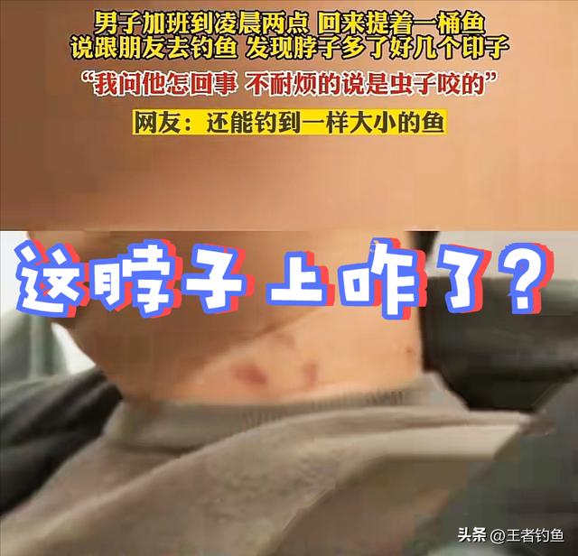 脖子上草莓印怎么在一晚消除，脖子上的草莓印一晚上能消除