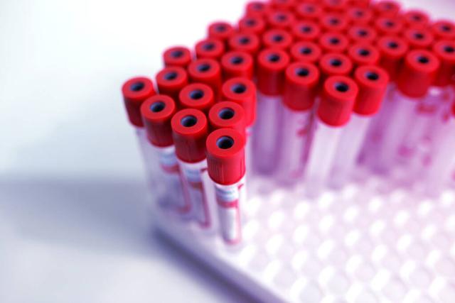 疫情期间有什么赚钱的机会呢，疫情期间有什么赚钱的机会呢知乎