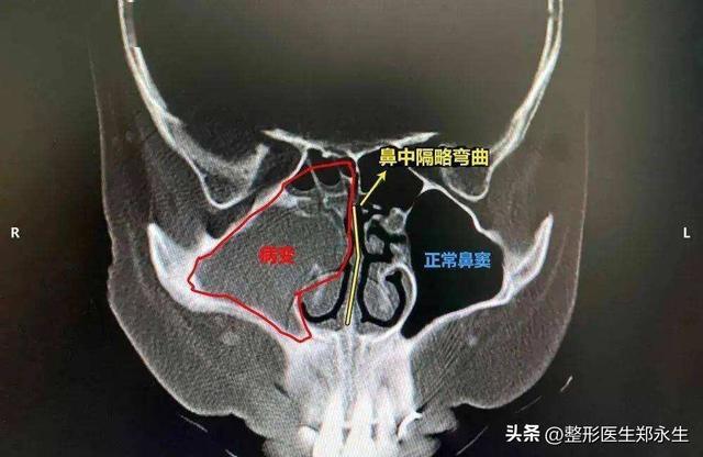 徒手正骨培训班学费一般多少,徒手正骨培训班学费一般多少钱