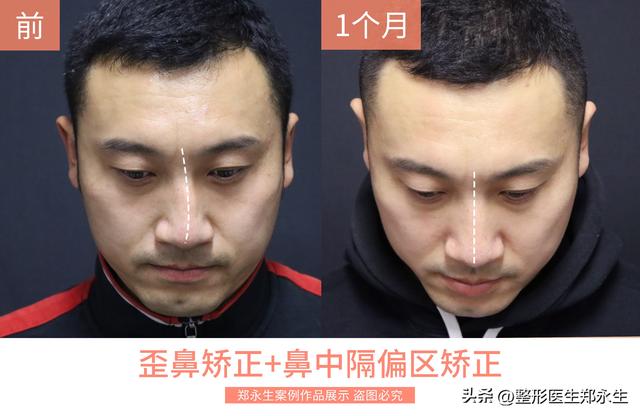 徒手正骨培训班学费一般多少,徒手正骨培训班学费一般多少钱