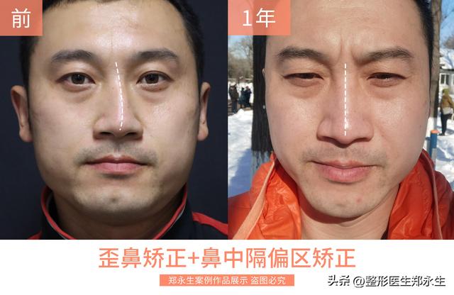 徒手正骨培训班学费一般多少,徒手正骨培训班学费一般多少钱